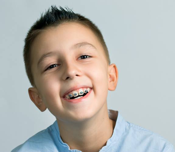young boy with Phase 1 orthodontics in Lake Zurich, IL