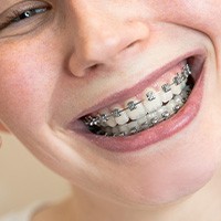 Patient with professional braces