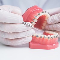 Dentist holding mouth mold with braces