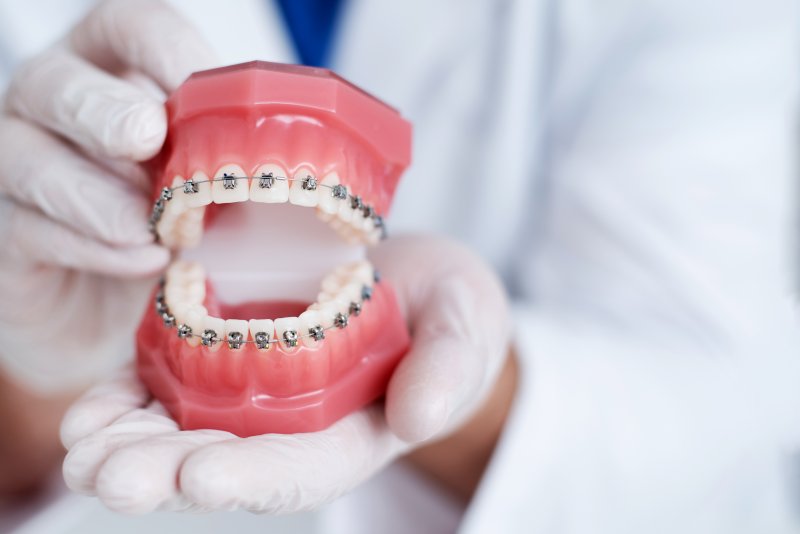 dentist holding mouth mold with braces